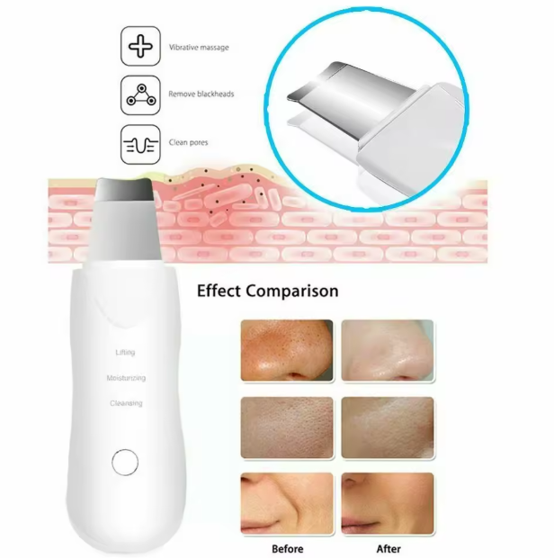 Limpiador Facial Ultrasónico