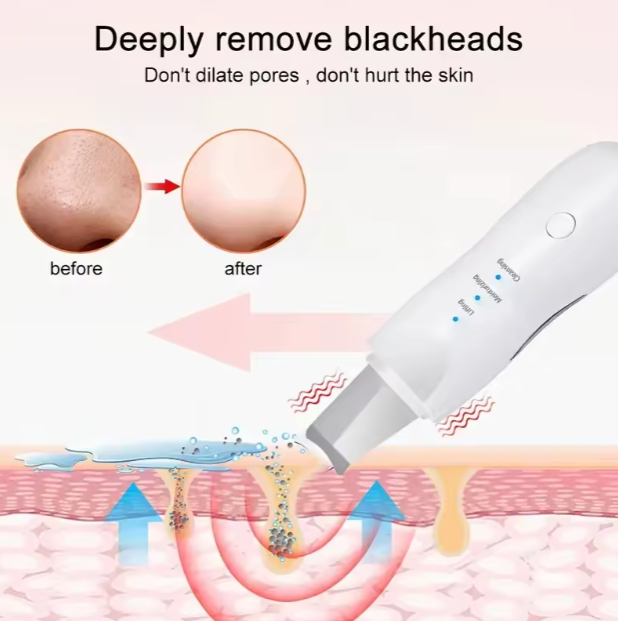 Limpiador Facial Ultrasónico